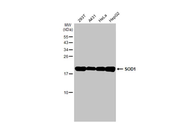 Anti-SOD1 antibody [HL2033] used in Western Blot (WB). GTX637934