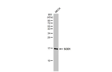 Anti-SOD1 antibody [HL2033] used in Western Blot (WB). GTX637934