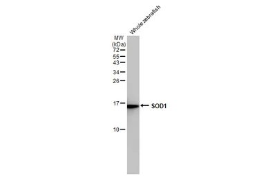 Anti-SOD1 antibody [HL2033] used in Western Blot (WB). GTX637934