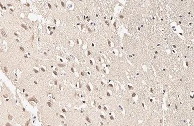 Anti-SOD1 antibody [HL2033] used in IHC (Paraffin sections) (IHC-P). GTX637934