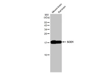 Anti-SOD1 antibody [HL2033] used in Western Blot (WB). GTX637934