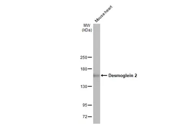 Anti-Desmoglein 2 antibody [HL2036] used in Western Blot (WB). GTX637937