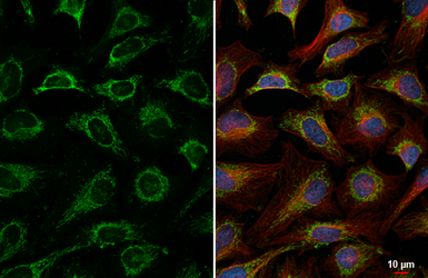 Anti-LRP130 antibody [HL2056] used in Immunocytochemistry/ Immunofluorescence (ICC/IF). GTX637960