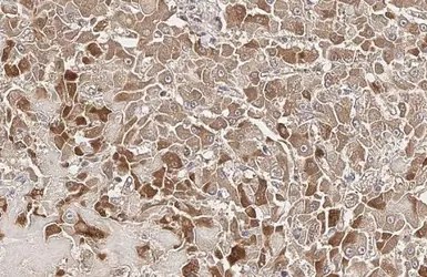 Anti-Plasminogen antibody [HL2071] used in IHC (Paraffin sections) (IHC-P). GTX637979