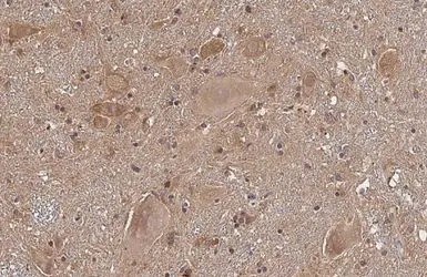 Anti-Plasminogen antibody [HL2071] used in IHC (Paraffin sections) (IHC-P). GTX637979