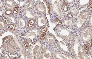 Anti-Plasminogen antibody [HL2071] used in IHC (Paraffin sections) (IHC-P). GTX637979