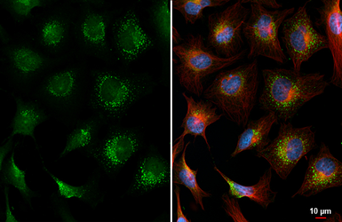 Anti-Plasminogen antibody [HL2071] used in Immunocytochemistry/ Immunofluorescence (ICC/IF). GTX637979