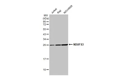 Anti-NDUFS3 antibody [HL2097] used in Western Blot (WB). GTX638005