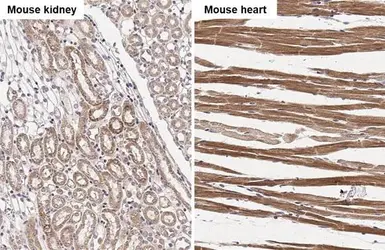 Anti-NDUFS3 antibody [HL2097] used in IHC (Paraffin sections) (IHC-P). GTX638005