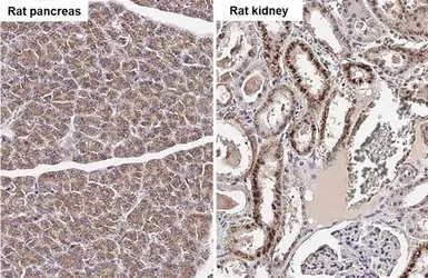 Anti-NDUFS3 antibody [HL2097] used in IHC (Paraffin sections) (IHC-P). GTX638005