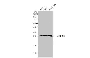 Anti-NDUFS3 antibody [HL2097] used in Western Blot (WB). GTX638005