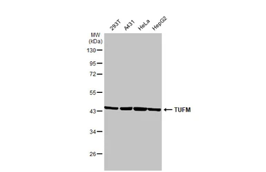 Anti-TUFM antibody [HL2117] used in Western Blot (WB). GTX638089