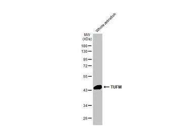 Anti-TUFM antibody [HL2117] used in Western Blot (WB). GTX638089