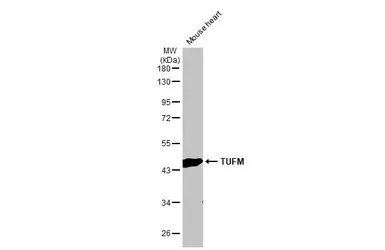 Anti-TUFM antibody [HL2117] used in Western Blot (WB). GTX638089