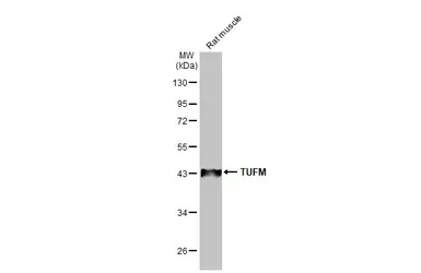 Anti-TUFM antibody [HL2117] used in Western Blot (WB). GTX638089