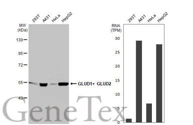 Anti-GLUD1+ GLUD2 antibody [HL2124] used in Western Blot (WB). GTX638096