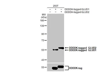 Anti-GLUD1+ GLUD2 antibody [HL2124] used in Western Blot (WB). GTX638096