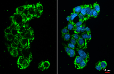 Anti-GLUD1+ GLUD2 antibody [HL2125] used in Immunocytochemistry/ Immunofluorescence (ICC/IF). GTX638097