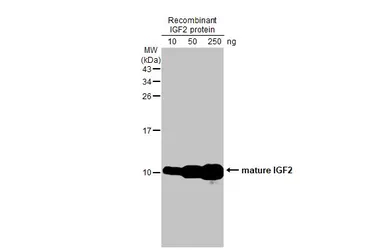 Anti-IGF2 antibody [HL2132] used in Western Blot (WB). GTX638104