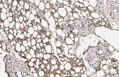 Anti-Fatty Acid Synthase antibody [HL2160] used in IHC (Paraffin sections) (IHC-P). GTX638138