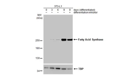 Anti-Fatty Acid Synthase antibody [HL2160] used in Western Blot (WB). GTX638138