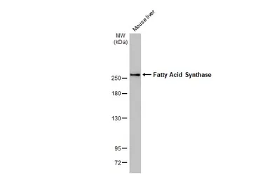 Anti-Fatty Acid Synthase antibody [HL2160] used in Western Blot (WB). GTX638138