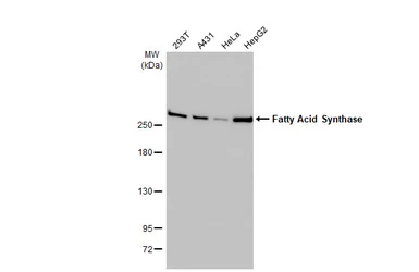 Anti-Fatty Acid Synthase antibody [HL2161] used in Western Blot (WB). GTX638139