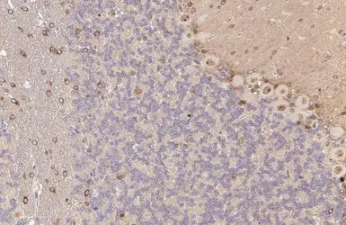 Anti-Fatty Acid Synthase antibody [HL2161] used in IHC (Paraffin sections) (IHC-P). GTX638139