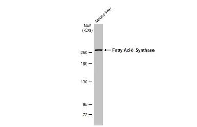 Anti-Fatty Acid Synthase antibody [HL2161] used in Western Blot (WB). GTX638139