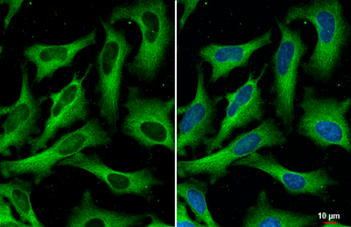 Anti-Fatty Acid Synthase antibody [HL2161] used in Immunocytochemistry/ Immunofluorescence (ICC/IF). GTX638139