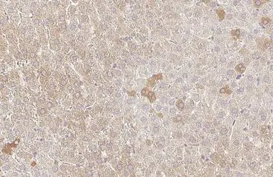 Anti-Fatty Acid Synthase antibody [HL2161] used in IHC (Paraffin sections) (IHC-P). GTX638139