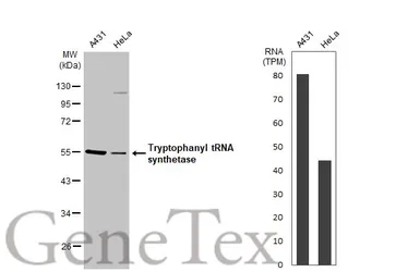 Anti-Tryptophanyl tRNA synthetase antibody [HL2186] used in Western Blot (WB). GTX638190