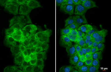 Anti-Tryptophanyl tRNA synthetase antibody [HL2186] used in Immunocytochemistry/ Immunofluorescence (ICC/IF). GTX638190