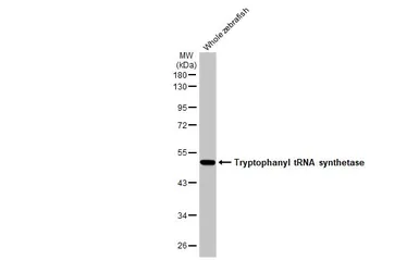 Anti-Tryptophanyl tRNA synthetase antibody [HL2186] used in Western Blot (WB). GTX638190