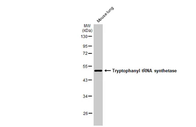 Anti-Tryptophanyl tRNA synthetase antibody [HL2186] used in Western Blot (WB). GTX638190