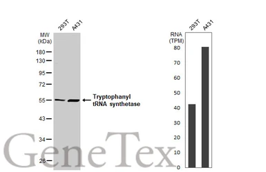 Anti-Tryptophanyl tRNA synthetase antibody [HL2186] used in Western Blot (WB). GTX638190