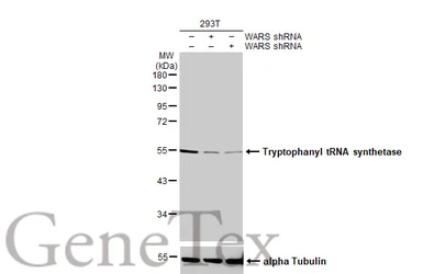 Anti-Tryptophanyl tRNA synthetase antibody [HL2186] used in Western Blot (WB). GTX638190