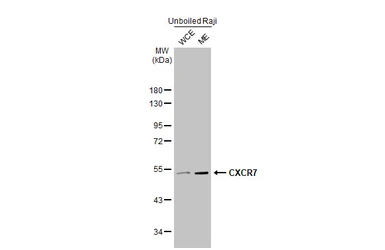 Anti-CXCR7 antibody [HL2189] used in Western Blot (WB). GTX638193