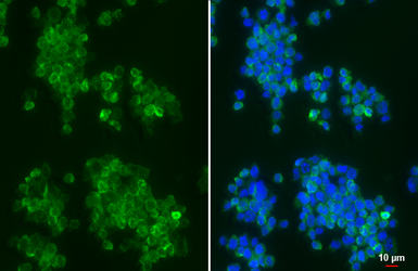 Anti-CXCR7 antibody [HL2189] used in Immunocytochemistry/ Immunofluorescence (ICC/IF). GTX638193