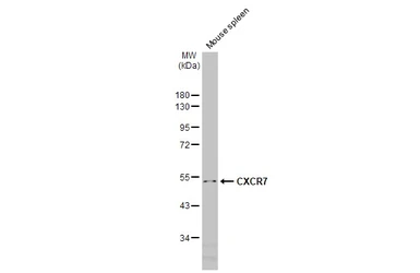 Anti-CXCR7 antibody [HL2189] used in Western Blot (WB). GTX638193