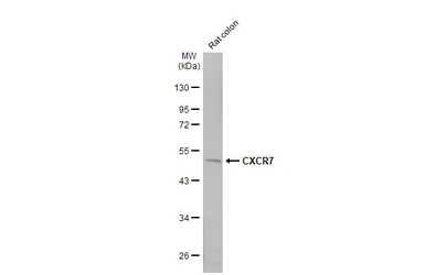 Anti-CXCR7 antibody [HL2189] used in Western Blot (WB). GTX638193