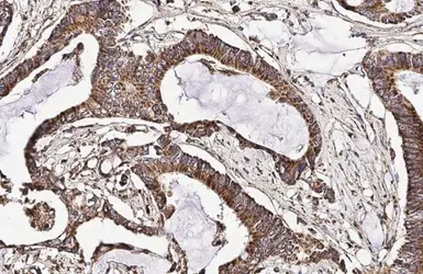 Anti-CXCR7 antibody [HL2189] used in IHC (Paraffin sections) (IHC-P). GTX638193