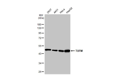 Anti-TUFM antibody [HL2193] used in Western Blot (WB). GTX638197