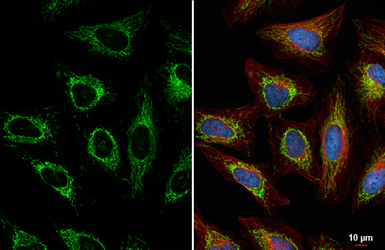 Anti-TUFM antibody [HL2193] used in Immunocytochemistry/ Immunofluorescence (ICC/IF). GTX638197