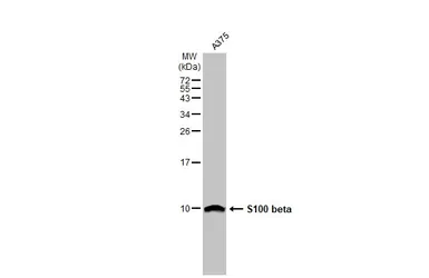 Anti-S100 beta antibody [HL2228] used in Western Blot (WB). GTX638273