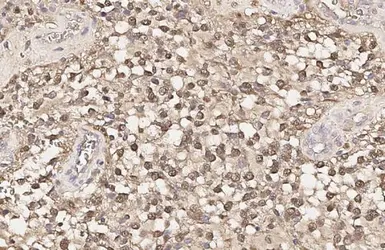 Anti-S100 beta antibody [HL2228] used in IHC (Paraffin sections) (IHC-P). GTX638273