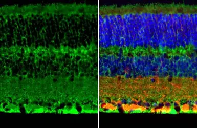 Anti-S100 beta antibody [HL2228] used in IHC (Paraffin sections) (IHC-P). GTX638273