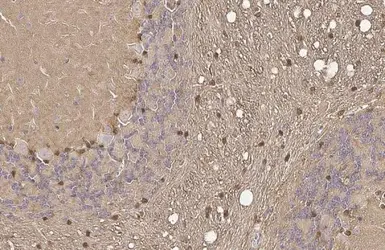 Anti-S100 beta antibody [HL2228] used in IHC (Paraffin sections) (IHC-P). GTX638273