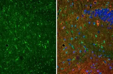 Anti-S100 beta antibody [HL2228] used in IHC (Paraffin sections) (IHC-P). GTX638273