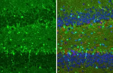 Anti-S100 beta antibody [HL2228] used in IHC (Paraffin sections) (IHC-P). GTX638273